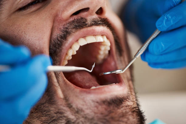 Best Emergency Dental Care for Abscessed Tooth in Forest City, IA